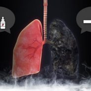 Vaping And Lung Problems